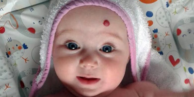 Ragam Tanda Lahir Pada Bayi